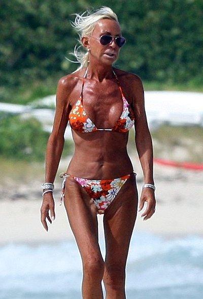 Donatella-Versace-10-Worst-Celebrity-Boob-Jobs