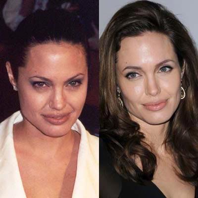 ANGELINA_BEFOREAFTER11