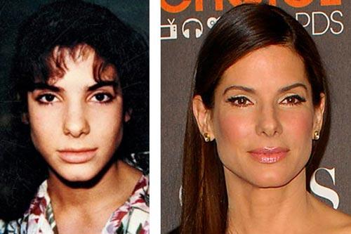 Celebrity-Sandra-Bullock-Nose-Job