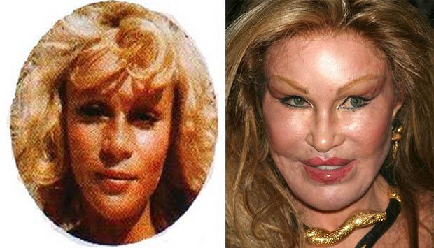 Jocelyn-Wildenstein-plastic-surgery