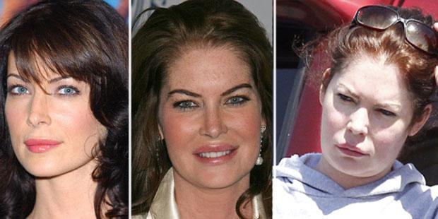 lara-flynn-boyle-plastic-surgery-before-and-after_2-1