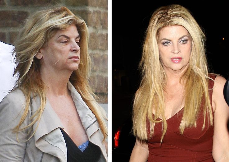 62992, NEW YORK, NEW YORK - Tuesday June 21, 2011. A barefaced Kirstie Alley leaves her hotel and heads to ABC Studios in NYC to host "The View". The former "Dancing with the Stars" contestant lost 60 pounds prior to her recent stint on the TV dance competition series and lost an additional 30 pounds during the competition itself. Alley has been busy promoting her product line, Organic Liasons, which focuses on organic living. Photograph: © Wagner Az, PacificCoastNews.com **FEE MUST BE AGREED PRIOR TO USAGE** **E-TABLET/IPAD & MOBILE PHONE APP PUBLISHING REQUIRES ADDITIONAL FEES** LOS ANGELES OFFICE:+1 310 822 0419 LONDON OFFICE:+44 20 8090 4079