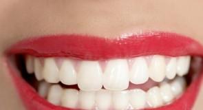 5 kroków do białego uśmiechu