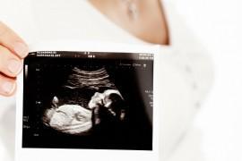 Badania prenatalne – co, kiedy i jak!