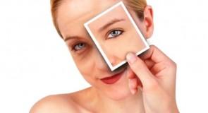 Cienie pod oczami. Jak się ich pozbyć?