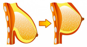 6 pozycji w JODZE, które ujędrniają piersi