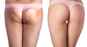 15-nasto minutowy trening ANTYCELLULITOWY