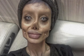 Kobieta wykonała ponad 50. operacji plastycznych, aby wyglądać tak jak Angelina Jolie