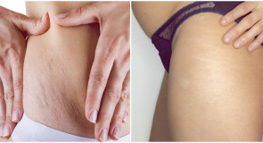 8 mitów na temat ROZSTĘPÓW