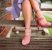 Pajączki na nogach – jak leczyć popękane naczynka?