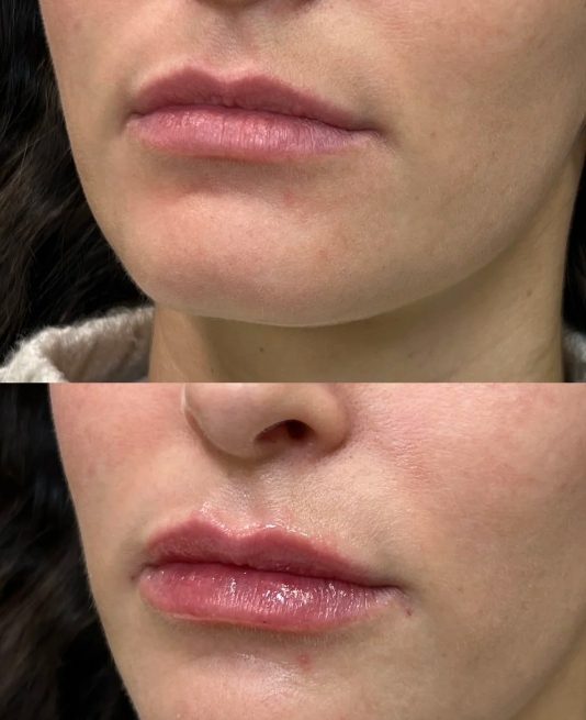 Medycyna estetyczna bez przerysowania. Te zabiegi są uznawane za najbezpieczniejsze przez lekarzy