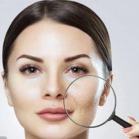 kobieta z idealną twarzą po zabiegu kosmetycznym