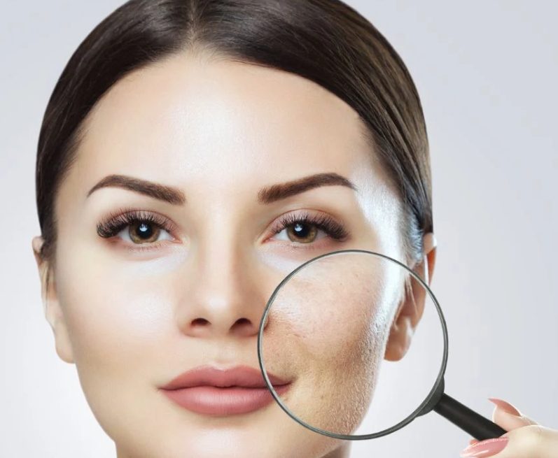 Najczęstsze mity, w które wierzą pacjentki. Lekarze prostują błędne przekonania o medycynie estetycznej