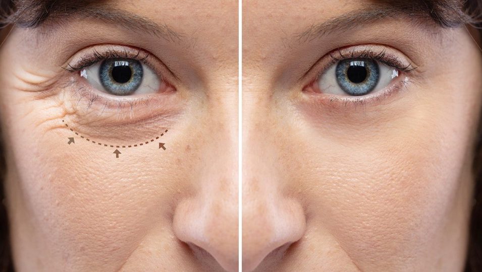 Jak zaplanować pierwszy rok zabiegów medycyny estetycznej? Plan krok po kroku (bez przesady i bez ryzyka)